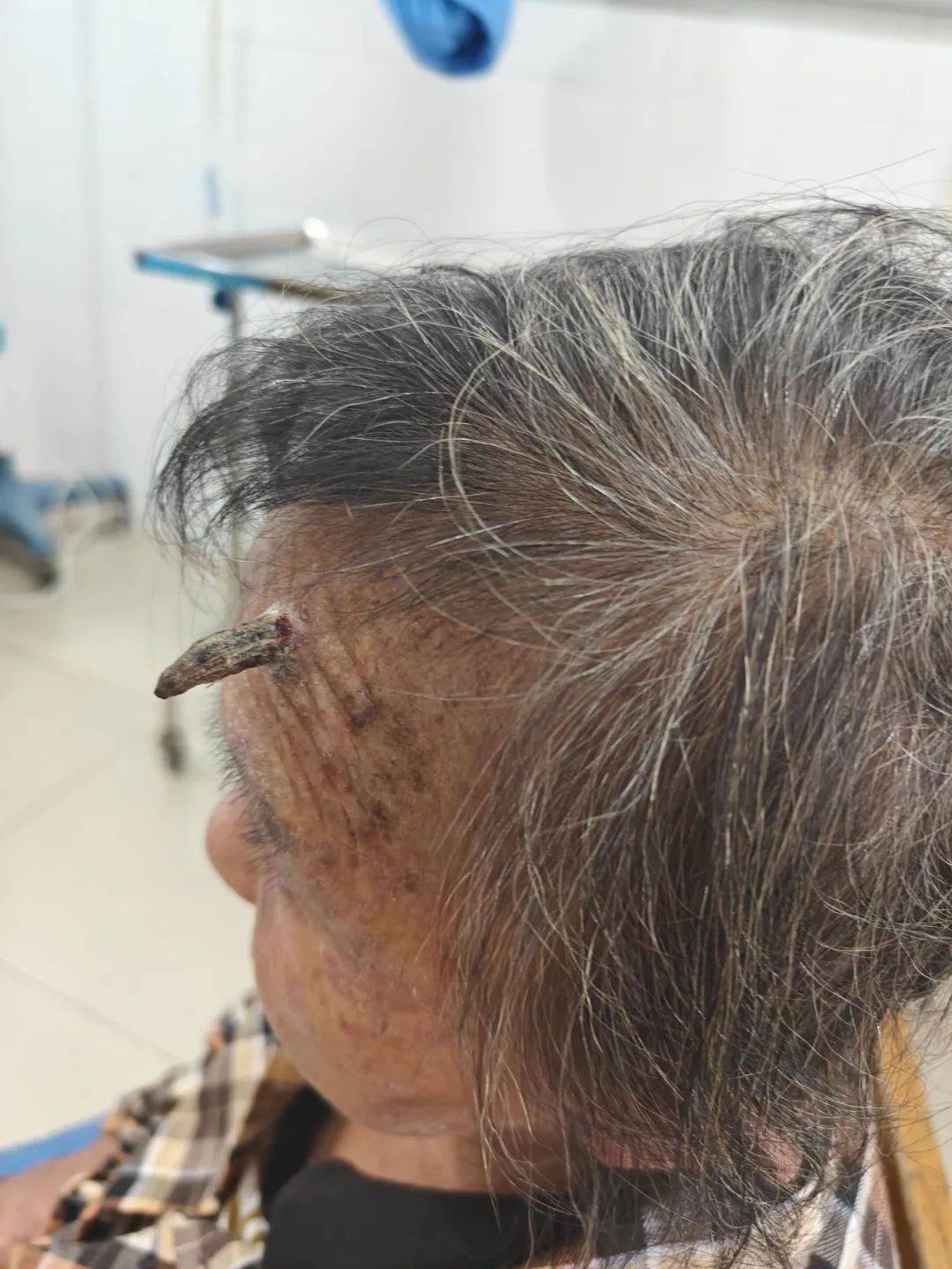 太狠了!98岁阿婆拿起剪刀,对准自已一刀下去…后果很严重!